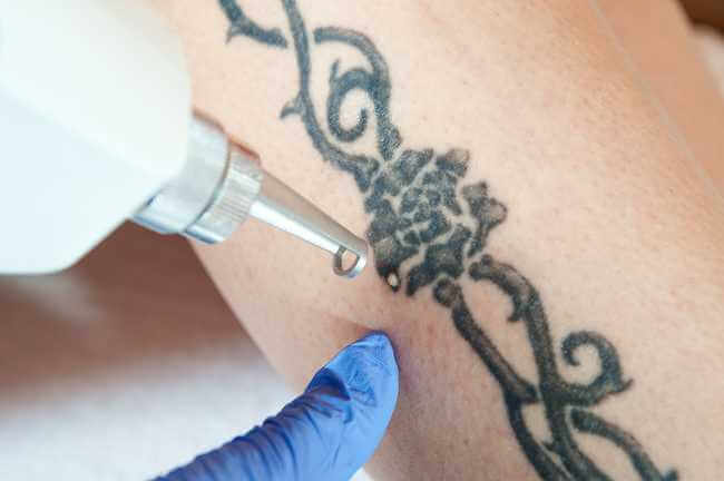 What Is QWO and How Does It Remove Cellulite?